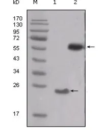 Anti-Src antibody [5D10C4] used in Western Blot (WB). GTX83021