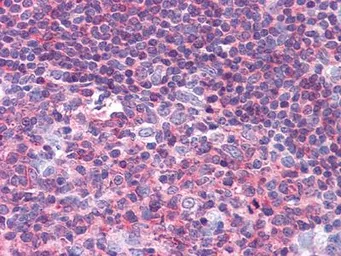 Anti-PYK2 antibody [5E2D5] used in IHC (Paraffin sections) (IHC-P). GTX83026