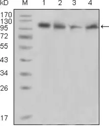 Anti-PYK2 antibody [5E2D5] used in Western Blot (WB). GTX83026