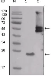Anti-Src antibody [4F1E8] used in Western Blot (WB). GTX83037
