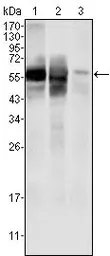Anti-GPI antibody [1B7D7] used in Western Blot (WB). GTX83039