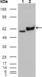 Anti-GPI antibody [1B7D7] used in Western Blot (WB). GTX83039