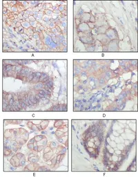 Anti-EphB3 antibody [4A122D1] used in IHC (Paraffin sections) (IHC-P). GTX83041