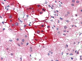 Anti-EphB3 antibody [4A122D1] used in IHC (Paraffin sections) (IHC-P). GTX83041