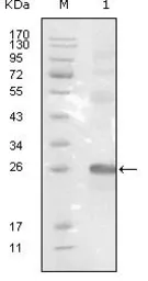 Anti-EphB3 antibody [4A122D1] used in Western Blot (WB). GTX83041