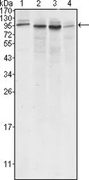 Anti-Calnexin antibody [3H4A7] used in Western Blot (WB). GTX83045