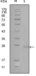 Anti-GATA3 antibody [1A10D1] used in Western Blot (WB). GTX83047