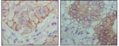 Anti-EphB1 antibody [5F10A4] used in IHC (Paraffin sections) (IHC-P). GTX83049