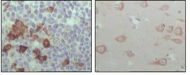 Anti-EphB6 antibody [2A6B9] used in IHC (Paraffin sections) (IHC-P). GTX83050