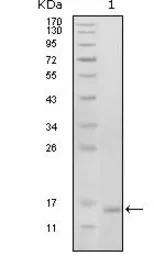 Anti-EphB6 antibody [2A6B9] used in Western Blot (WB). GTX83050