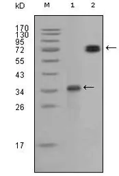 Anti-Ret antibody [8D10C9] used in Western Blot (WB). GTX83058