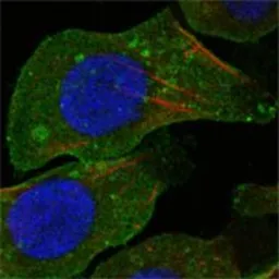 Anti-DDR2 antibody [3B11E4] used in Immunocytochemistry/ Immunofluorescence (ICC/IF). GTX83062