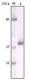 Anti-DDR2 antibody [3B11E4] used in Western Blot (WB). GTX83062