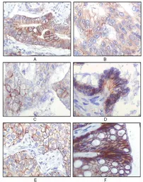 Anti-IGF1R beta antibody [3C8B1] used in IHC (Paraffin sections) (IHC-P). GTX83067