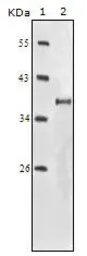 Anti-IGF1R beta antibody [3C8B1] used in Western Blot (WB). GTX83067