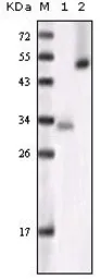 Anti-GSK3 alpha antibody [6G12C2] used in Western Blot (WB). GTX83071