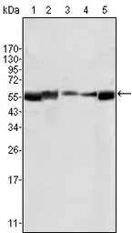 Anti-LYN antibody [2H8D7] used in Western Blot (WB). GTX83072