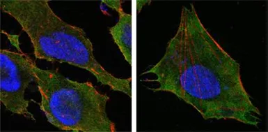 Anti-S100A10 antibody [4E7E10] used in Immunocytochemistry/ Immunofluorescence (ICC/IF). GTX83075