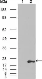 Anti-GSTP1 antibody [3F2C2] used in Western Blot (WB). GTX83077
