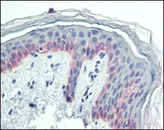 Anti-Cytokeratin 5 antibody [3E2F1] used in IHC (Paraffin sections) (IHC-P). GTX83080
