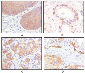 Anti-Cytokeratin 5 antibody [3E2F1] used in IHC (Paraffin sections) (IHC-P). GTX83080