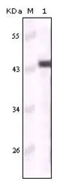 Anti-Cytokeratin 5 antibody [3E2F1] used in Western Blot (WB). GTX83080