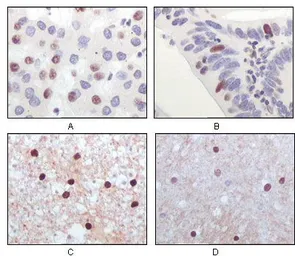 Anti-TIP60 antibody [3F9] used in IHC (Paraffin sections) (IHC-P). GTX83081