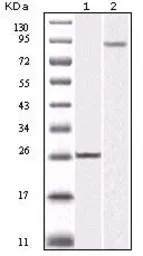 Anti-IKK beta antibody [10A2] used in Western Blot (WB). GTX83086
