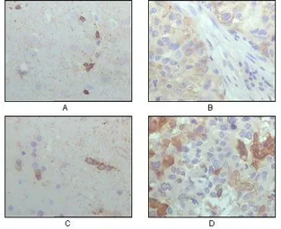 Anti-alpha B Crystallin antibody [1D11C6E6] used in IHC (Paraffin sections) (IHC-P). GTX83088