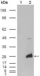 Anti-alpha B Crystallin antibody [1D11C6E6] used in Western Blot (WB). GTX83088