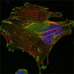 Anti-LPP antibody [8B3A11] used in Immunocytochemistry/ Immunofluorescence (ICC/IF). GTX83092