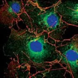 Anti-LPP antibody [8B3A11] used in Immunocytochemistry/ Immunofluorescence (ICC/IF). GTX83092