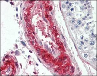 Anti-LPP antibody [8B3A11] used in IHC (Paraffin sections) (IHC-P). GTX83092