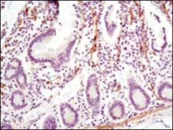 Anti-LPP antibody [8B3A11] used in IHC (Paraffin sections) (IHC-P). GTX83092