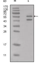 Anti-Calreticulin antibody used in Western Blot (WB). GTX83093