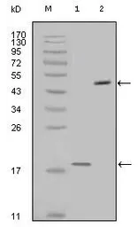 Anti-Survivin antibody [2H5H2] used in Western Blot (WB). GTX83094