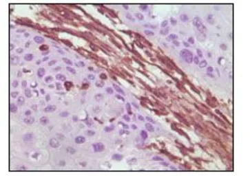 Anti-Vimentin antibody [4F2E9] used in IHC (Paraffin sections) (IHC-P). GTX83095