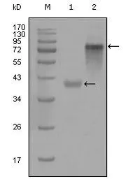 Anti-Cytokeratin 19 antibody [4F12G9] used in Western Blot (WB). GTX83099