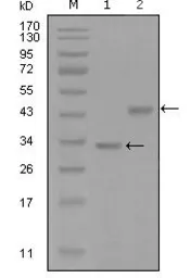 Anti-SKP2 antibody [6G9D10] used in Western Blot (WB). GTX83106