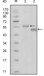Anti-EphA6 antibody [3D5B10] used in Western Blot (WB). GTX83108