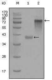 Anti-Cytokeratin 19 antibody [9H8G6] used in Western Blot (WB). GTX83113