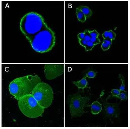 Anti-CD44 antibody [8E2F3] used in Immunocytochemistry/ Immunofluorescence (ICC/IF). GTX83114