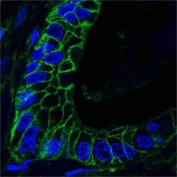 Anti-CD44 antibody [8E2F3] used in IHC (Paraffin sections) (IHC-P). GTX83114