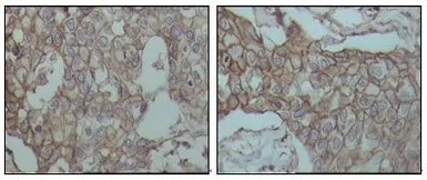Anti-CD44 antibody [8E2F3] used in IHC (Paraffin sections) (IHC-P). GTX83114