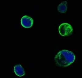 Anti-MUSK antibody [10A4] used in Immunocytochemistry/ Immunofluorescence (ICC/IF). GTX83118