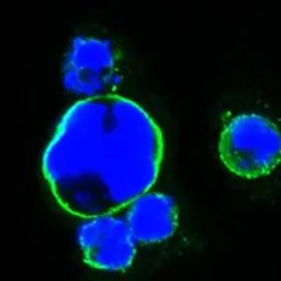Anti-Islet 1 antibody [1H9] used in Immunocytochemistry/ Immunofluorescence (ICC/IF). GTX83121