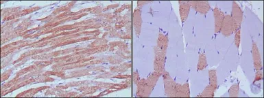 Anti-Myosin Light Chain 3 antibody [7C1] used in IHC (Paraffin sections) (IHC-P). GTX83122