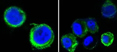 Anti-AXL antibody [7E10] used in Immunocytochemistry/ Immunofluorescence (ICC/IF). GTX83125