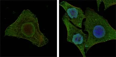 Anti-B-Raf antibody [1H12] used in Immunocytochemistry/ Immunofluorescence (ICC/IF). GTX83134