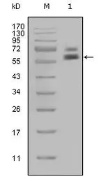 Anti-Cytokeratin 5 antibody [1E1] used in Western Blot (WB). GTX83135